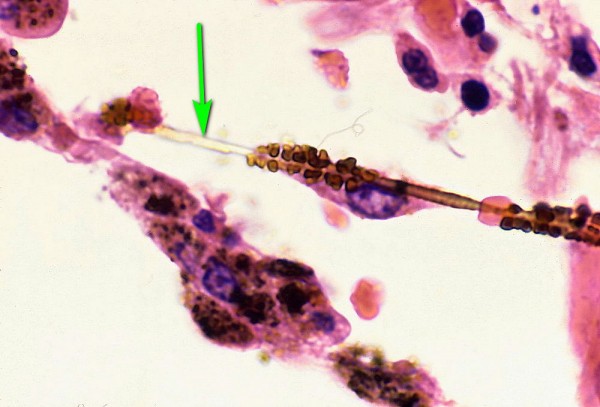 Какой материал для дымохода лучше: ТОП-5 популярных материалов для дымоходов