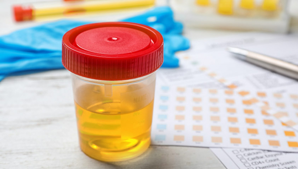 Какой септик лучше для частного дома: разбираемся в системах автономной канализации