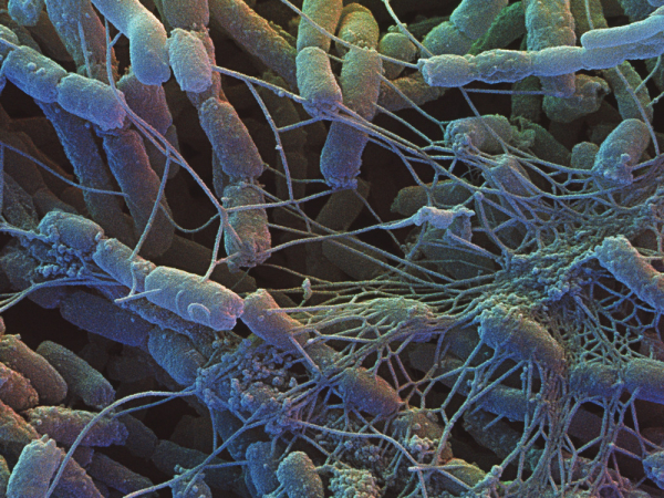 Антисептики для туалета на даче: какое средство избавит от запаха раз и навсегда